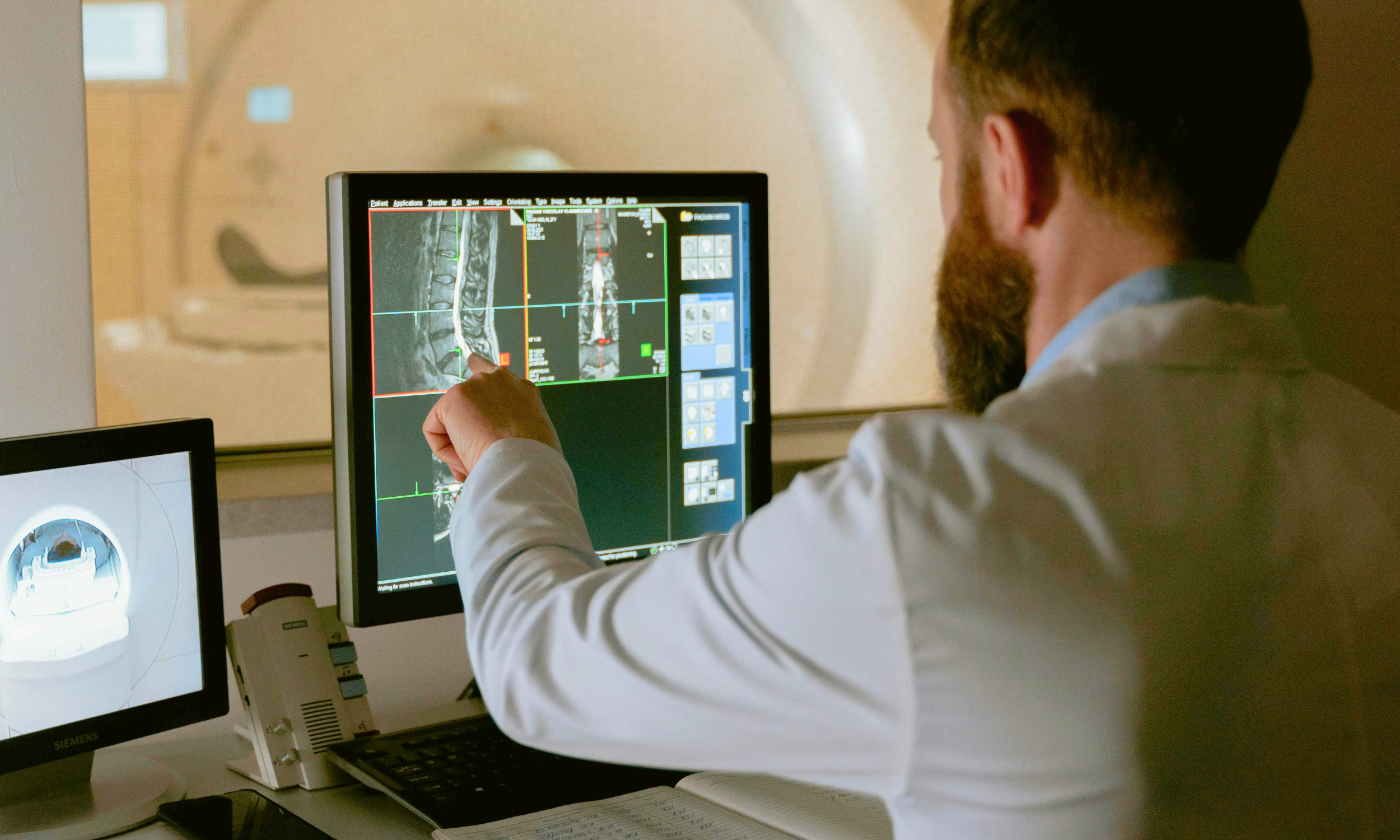 Radiologist reviewing AI-assisted CT scan results on a monitor